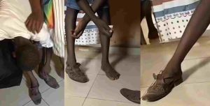 Reactions trail as mother forces son to wear father’s shoe to school resumption