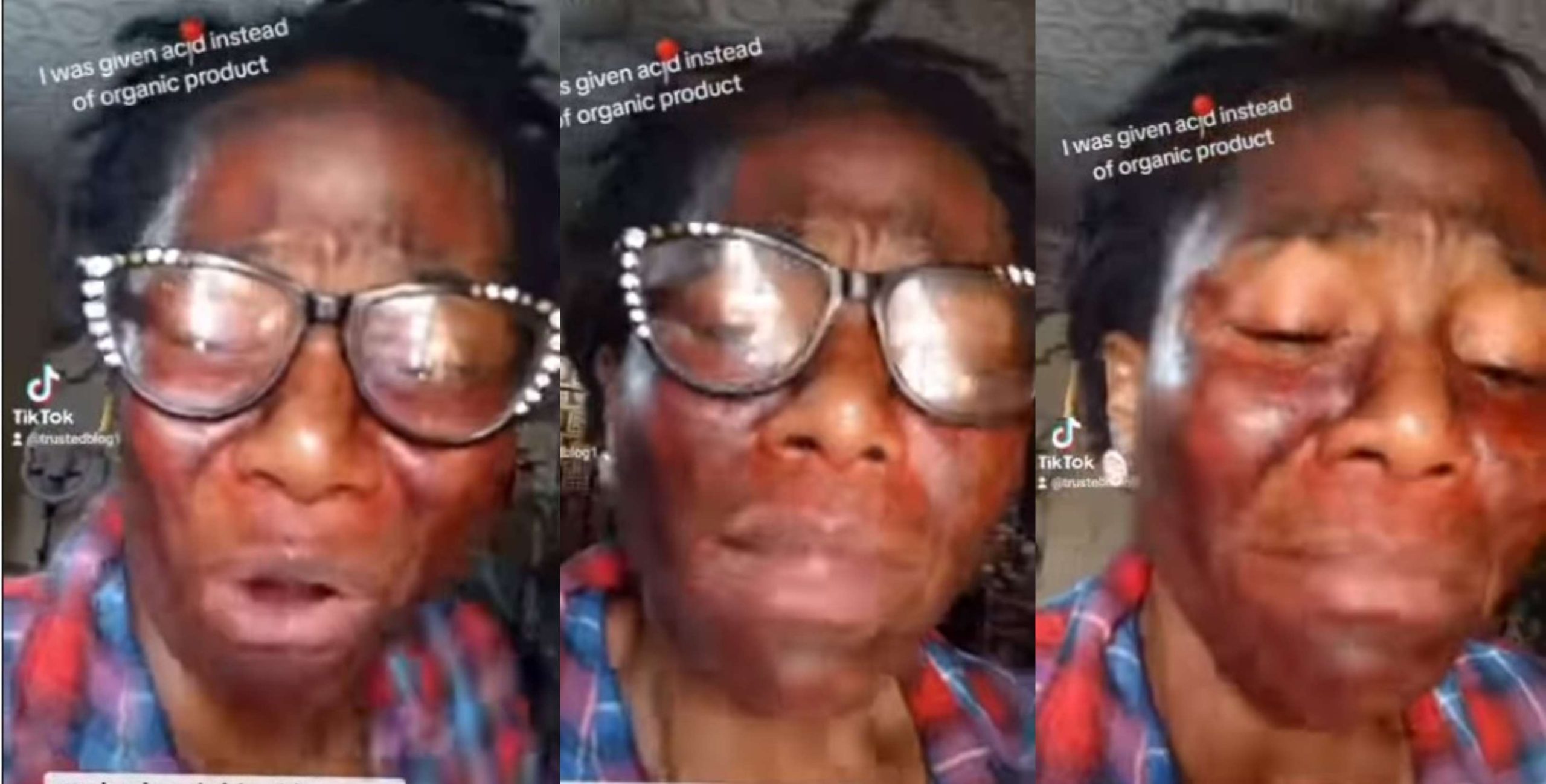 My husband’s side chic gave me acid as organic product for face – Woman cries out